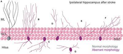 Post-stroke Neurogenesis: Friend or Foe?